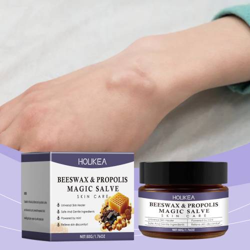 Houkea Propolis Body Care Cream, Nourishes Skin Care For Discomfort Gently Apply Skin Body Care Cream