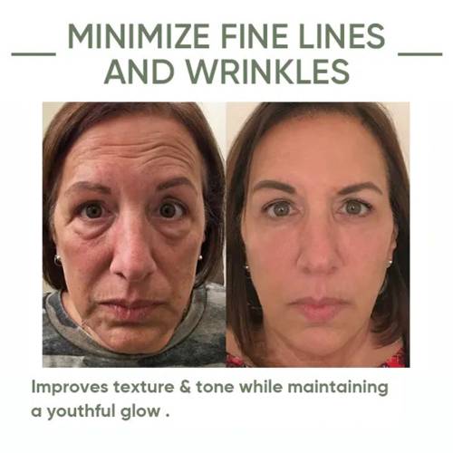 OUHOE Avocado Care Essence Firming Facial Skin, Reducing Fine Lines, Hydrating And Moisturizing Skin Care Essence